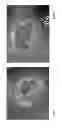 Fig. 03 - HEMOSTATIC COMPOSITIONS