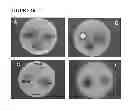 Fig. 10 - Light Insensitive Silver(i) Cyanoximates As Antimicrobial Agents For Indwelling Medical Devices