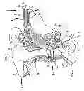 Fig. 01 - IMPLANTABLE MEDICAL DEVICE