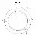 Fig. 09 - IMPLANTABLE MEDICAL DEVICE