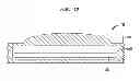Fig. 13 - IMPLANTABLE MEDICAL DEVICE