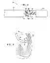 Fig. 03 - Catheter with pressure sensing