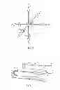 Fig. 02 - Incision-less laparoscopic instrument