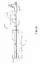 Fig. 02 - Integrated crossing balloon catheter