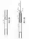 Fig. 09 - Integrated crossing balloon catheter