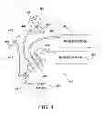 Fig. 06 - Archery apparatus, system, and method with automatic device activation