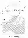 Fig. 02 - Laryngeal Mask