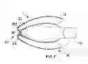 Fig. 04 - Laryngeal Mask
