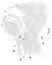 Fig. 06 - Laryngeal Mask