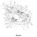 Fig. 02 - Mandibular advancement device with positive positioning hinge