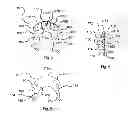 Fig. 03 - Device for mitigation of temporomandibular joint disorder