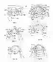Fig. 04 - Device for mitigation of temporomandibular joint disorder