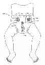 Fig. 01 - Method of separating a discrete portion from a web
