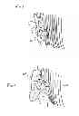 Fig. 03 - Hearing assistance device