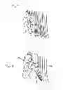 Fig. 05 - Hearing assistance device