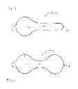 Fig. 07 - Hearing assistance device