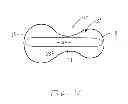 Fig. 08 - Hearing assistance device