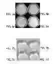 Fig. 06 - PARALLEL MAGNETIC RESONANCE IMAGING USING UNDERSAMPLED COIL DATA FOR COIL SENSITIVITY ESTIMATION
