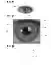 Fig. 02 - Colored contact lens