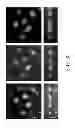 Fig. 09 - Optical imaging system using structured illumination