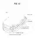 Fig. 14 - Imaging lens and imaging device