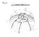 Fig. 03 - Device to reflect in a desired direction a laser beam emitted by a laser device mounted with an aircraft