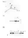 Fig. 06 - Ultraviolet laser