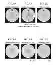 Fig. 07 - Method and system for substantially reducing ring artifact based upon ring statistics