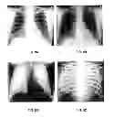 Fig. 09 - Apparatus for generating multi-energy x-ray images and methods of using the same