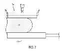 Fig. 07 - Method and apparatus for dual-modality ultrasonic and nuclear emission mammography