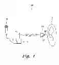 Fig. 02 - Selective filtering earplugs
