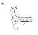 Fig. 02 - Inflatable ear mold connection system