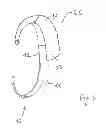 Fig. 07 - Hearing aid retainer accessory