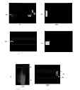 Fig. 01 - Method of image processing and device therefore