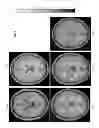 Fig. 09 - System and method for medical image intensity standardization