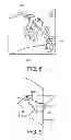 Fig. 08 - Navigating an interventional device