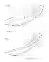 Fig. 07 - AERODYNAMIC MODIFICATION OF A RING FOIL FOR A FLUID TURBINE
