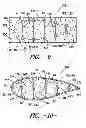 Fig. 08 - Rotor blade for a wind turbine and methods of manufacturing the same