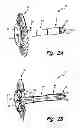 Fig. 03 - Shaft cap