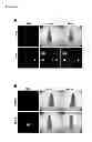 Fig. 49 - METHOD OF USING NEAR INFRARED FLUORESCENT DYES FOR IMAGING AND TARGETING CANCERS
