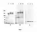 Fig. 10 - Protein-polymer-drug conjugates