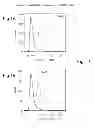 Fig. 02 - BCMA-BASED STRATIFICATION AND THERAPY FOR MULTIPLE  MYELOMA PATIENTS