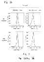 Fig. 06 - BCMA-BASED STRATIFICATION AND THERAPY FOR MULTIPLE  MYELOMA PATIENTS