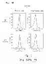 Fig. 07 - BCMA-BASED STRATIFICATION AND THERAPY FOR MULTIPLE  MYELOMA PATIENTS