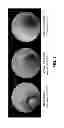Fig. 08 - METHODS AND COMPOSITIONS FOR MITIGATING PROCTITIS