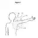 Fig. 02 - Methods and materials for reducing the risk of infections