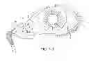 Fig. 02 - Drug delivery methods, structures, and compositions for nasolacrimal system
