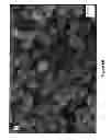 Fig. 09 - LOGICAL ENZYME TRIGGERED (LET) LAYER-BY-LAYER NANOCAPSULES FOR DRUG DELIVERY SYSTEM