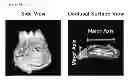 Fig. 04 - Method For Restoring Alveolar Bone Via Transplant of a Regenerated Tooth Unit