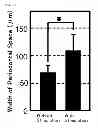 Fig. 08 - Method For Restoring Alveolar Bone Via Transplant of a Regenerated Tooth Unit